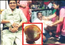 माजी नगरसेविका माधुरी प्रशांत काळे यांनी भावाचा जिव वाचविण्यासाठी दिला स्वःताच्या काळजाचा तुकडा